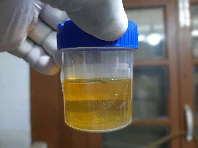 Urine sample